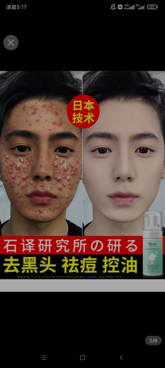 沁花木子日本氨基酸洗面奶控油祛痘美白去黑头...