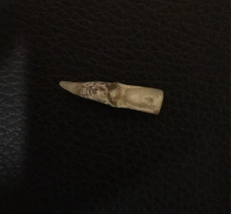 现出售本人38周岁下门牙牙齿一颗,有意者联...